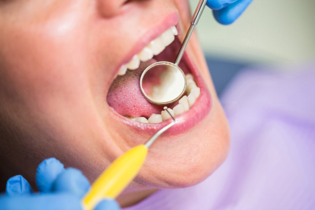 Dental Abscesses