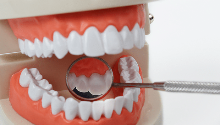 Healthy Teeth