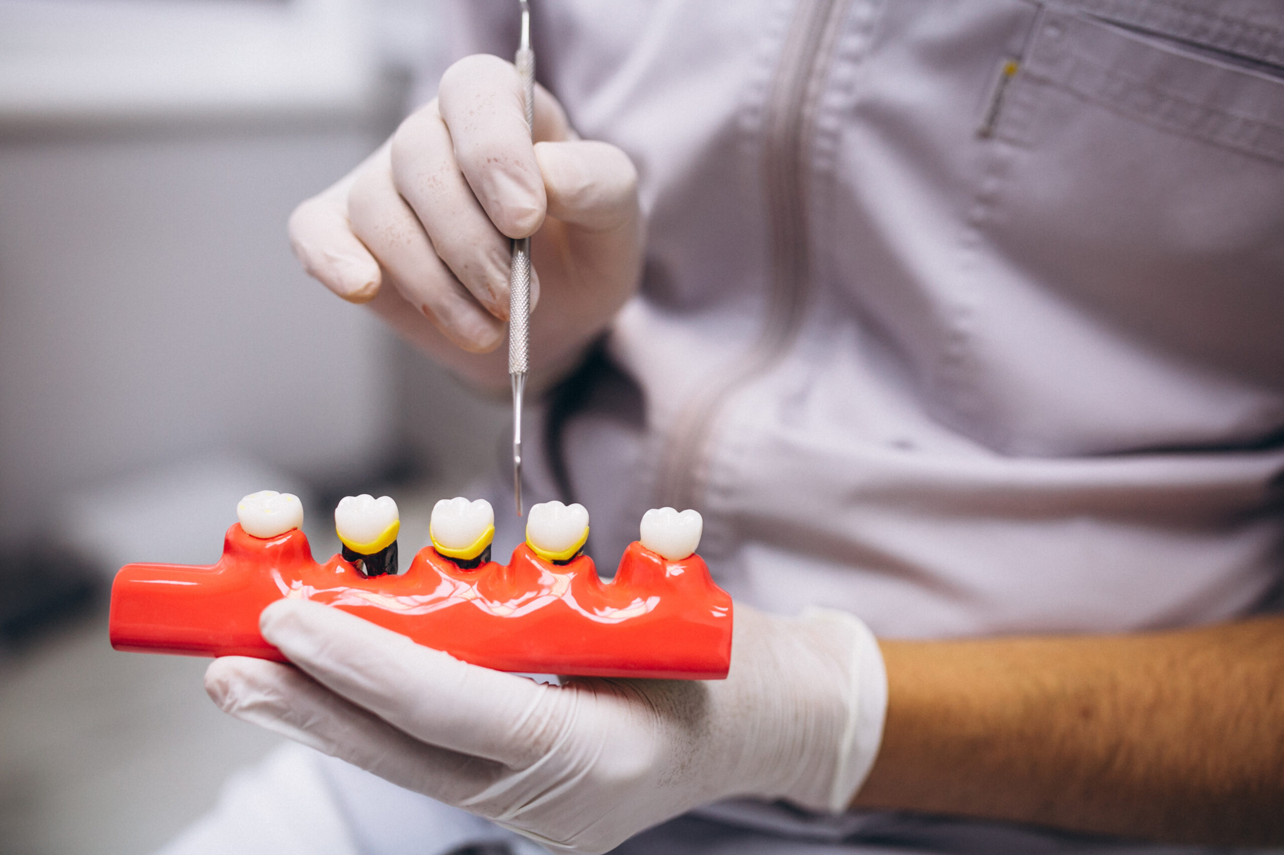 Dental implants treatment