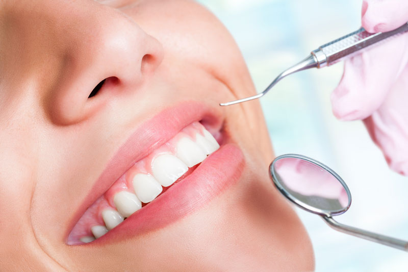 Teeth Bleaching
