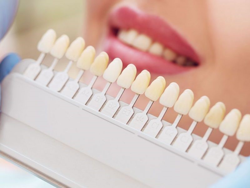 Tooth cleaning