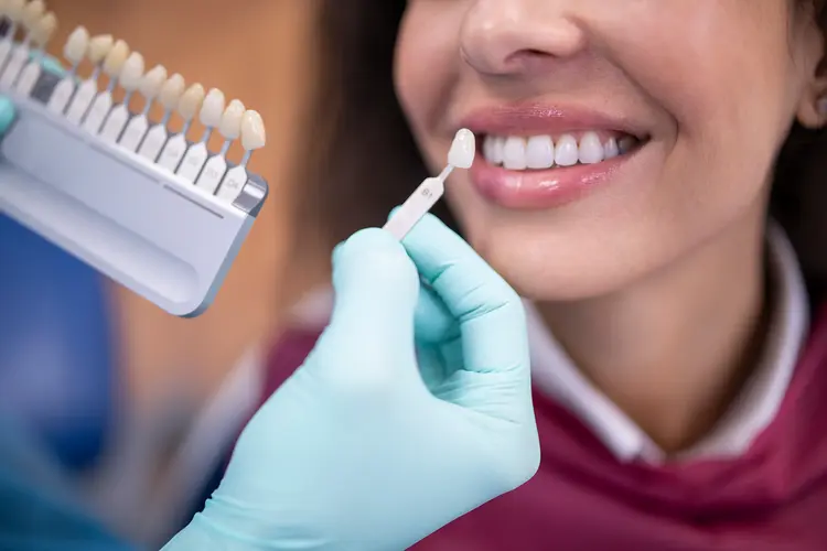 dental veneers treatment